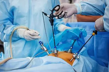 prostate gland surgery cost in india